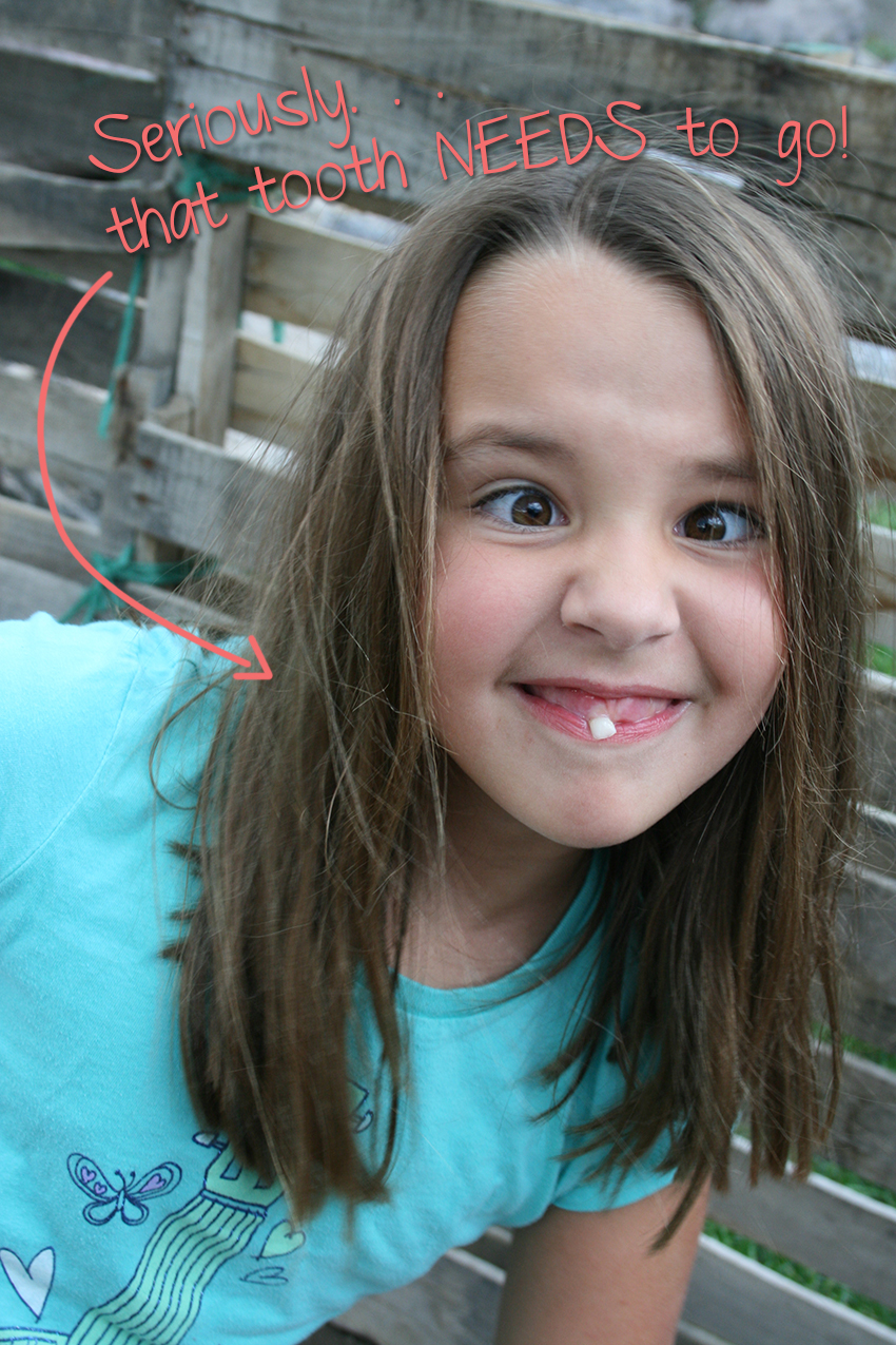 What a goofball! And that tooth has got to go!